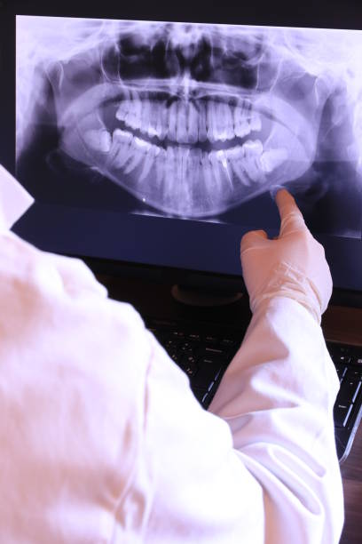 Best Emergency Wisdom Teeth Removal in Port Hadlock Irondale, WA